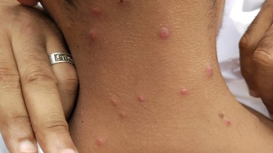 أمراض جلدية غريبة تصيب عدة دوائر بإقليم طاطا