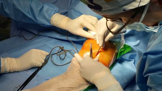 إيقاف عملية جراحية في وجدة يثير الجدل.. حقوق الإنسان يطالب بتحقيق شفاف