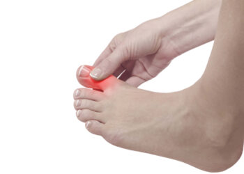 النقرس… حين يتحوّل المفصل إلى مركز صراع صامت